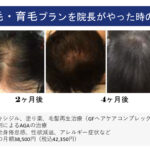 びまん 性 脱毛 症 シャンプー