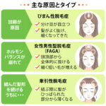 毛 抜ける 原因