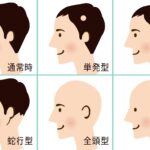 粃 糠 性 脱毛 症 シャンプー
