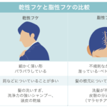 粃 糠 性 脱毛 症 シャンプー