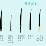 髪 が 抜け やすい